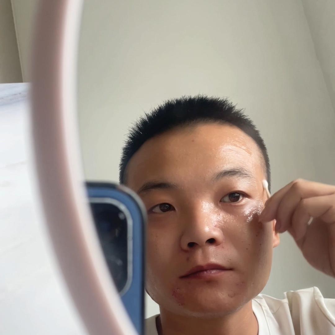 抗痘战士