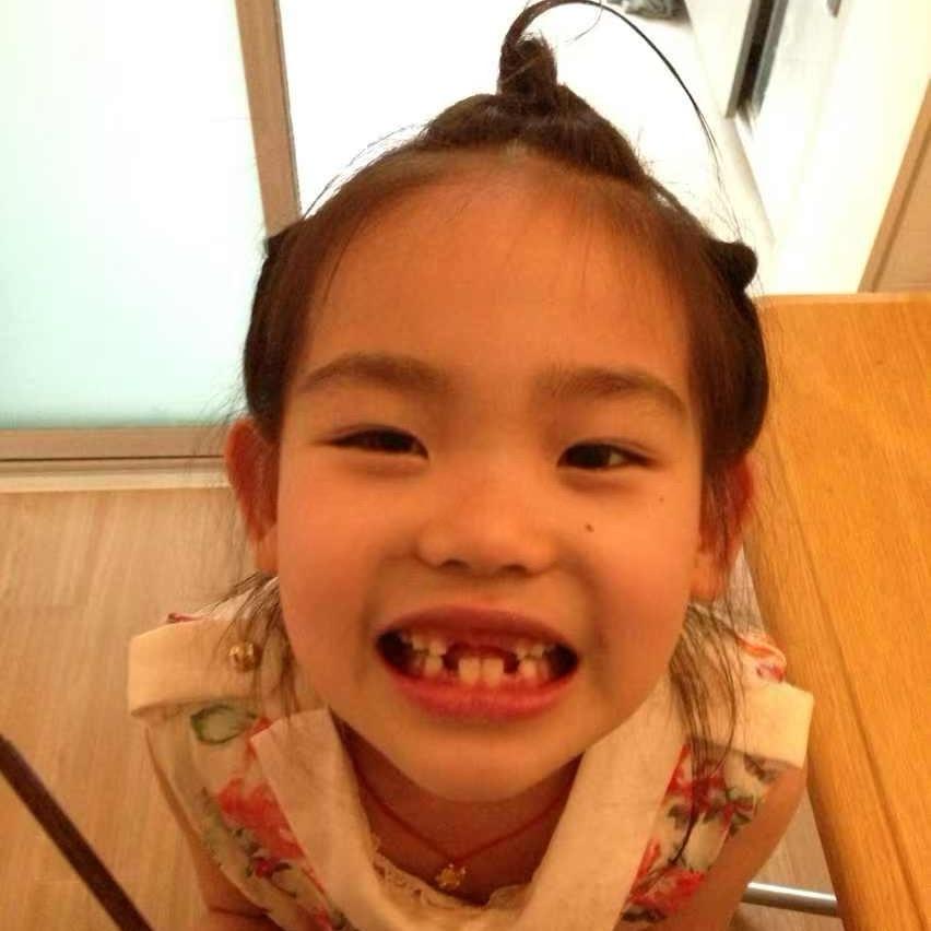 米司张