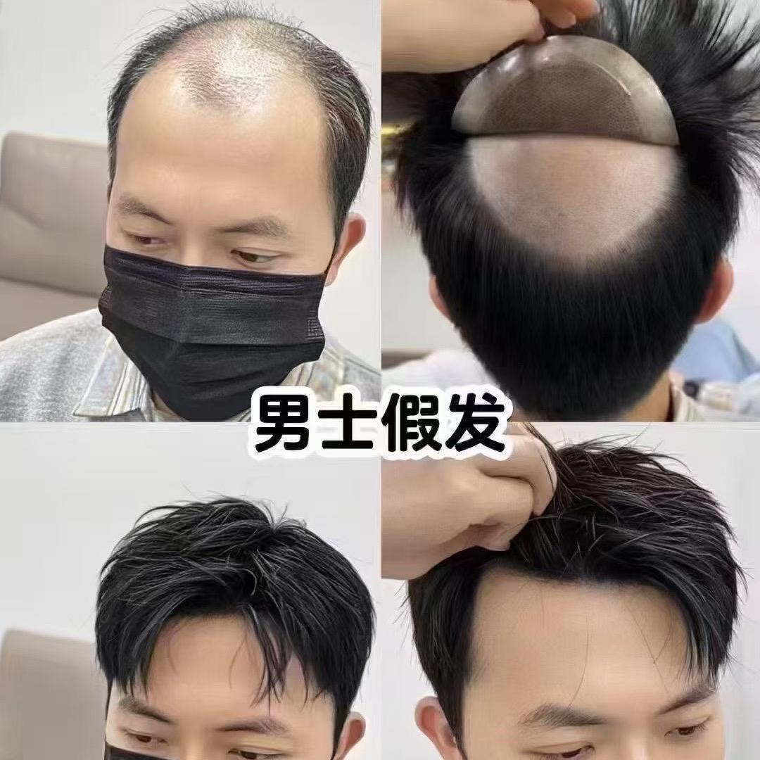 重庆店创优假发定制、蒋涛