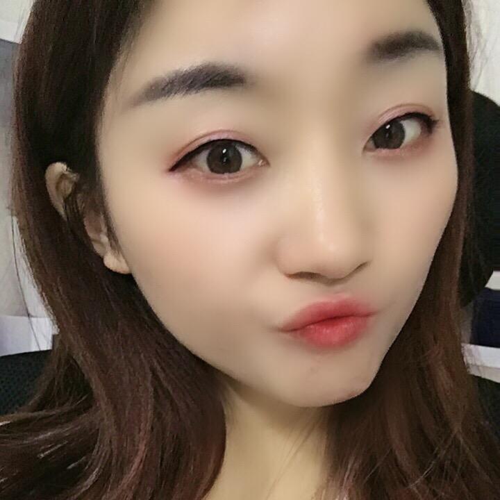 小美 ✌🏻661