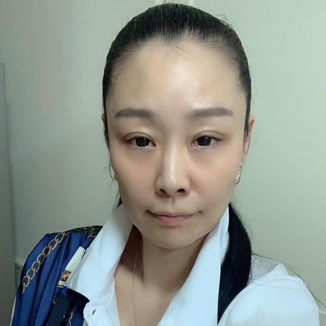 邱瑾