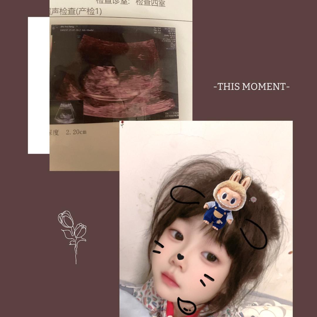 芳芳姐姐❤️（孕晚期）