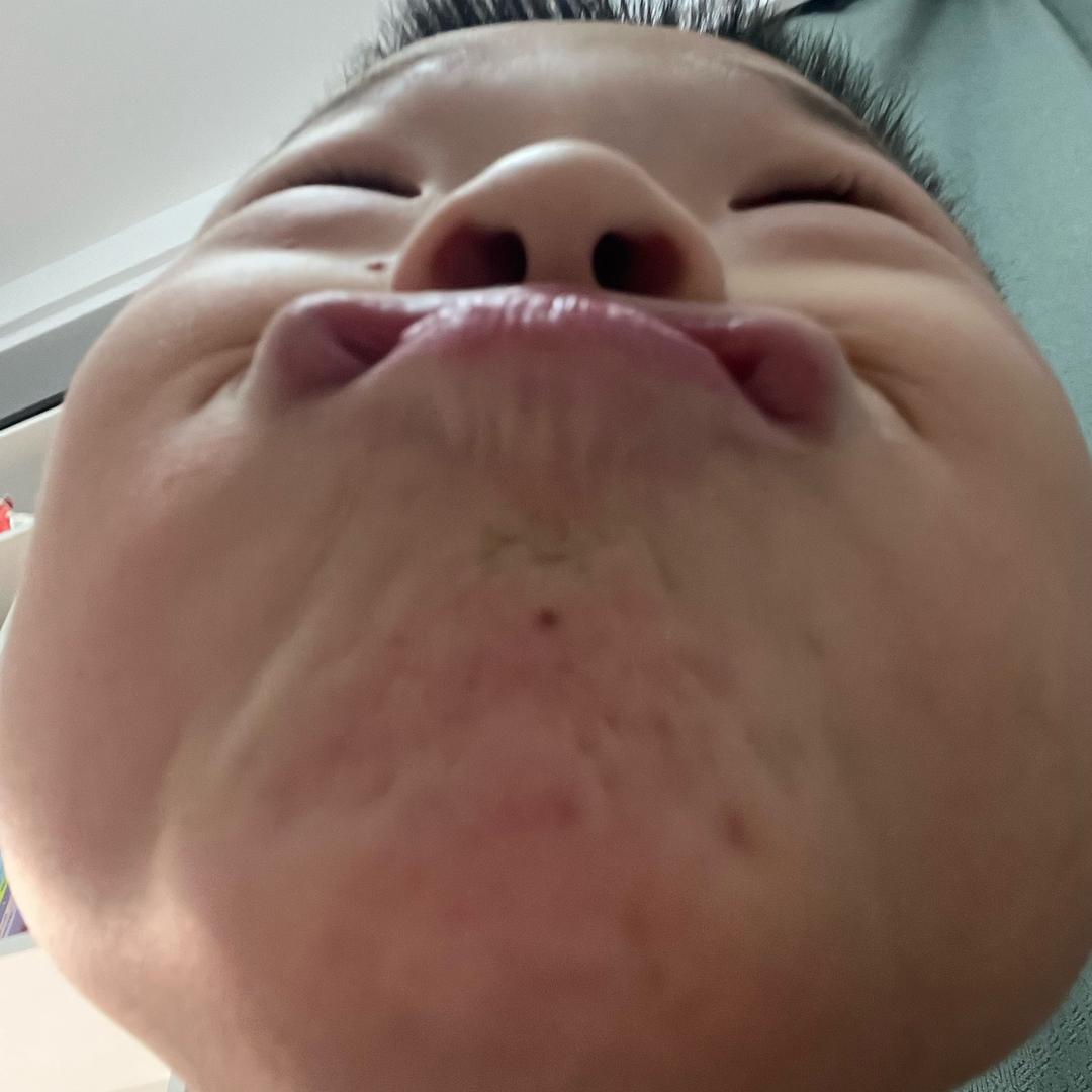 琪琪