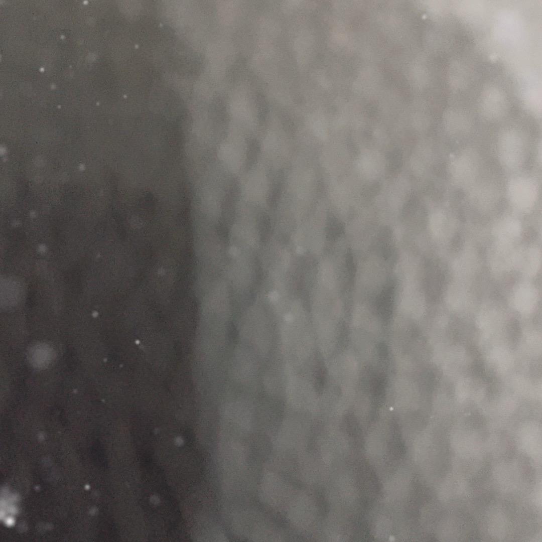 呃逆最近