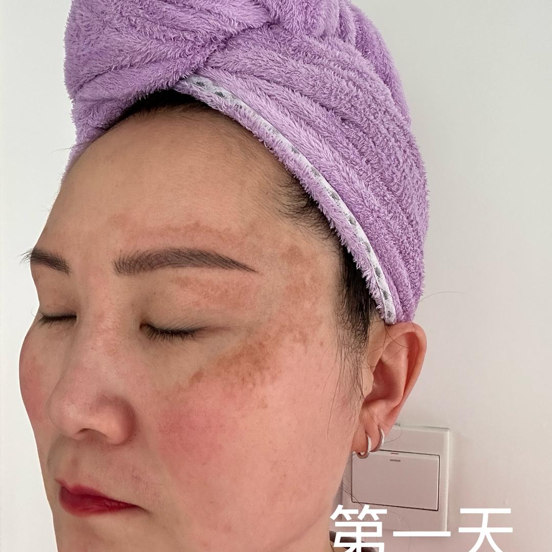 养肤淡斑白透亮✨3
