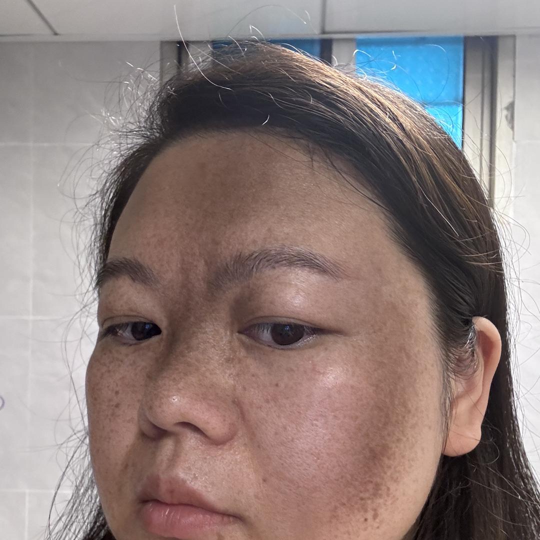 璇小璐