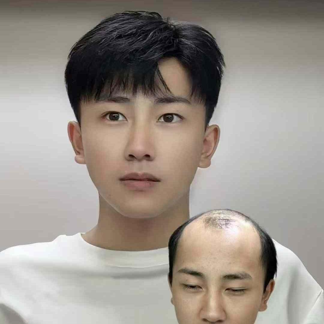 武汉发丝特假发鑫姐