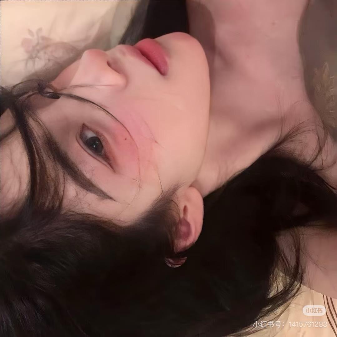 猕猴桃🥝.（🍑过敏）