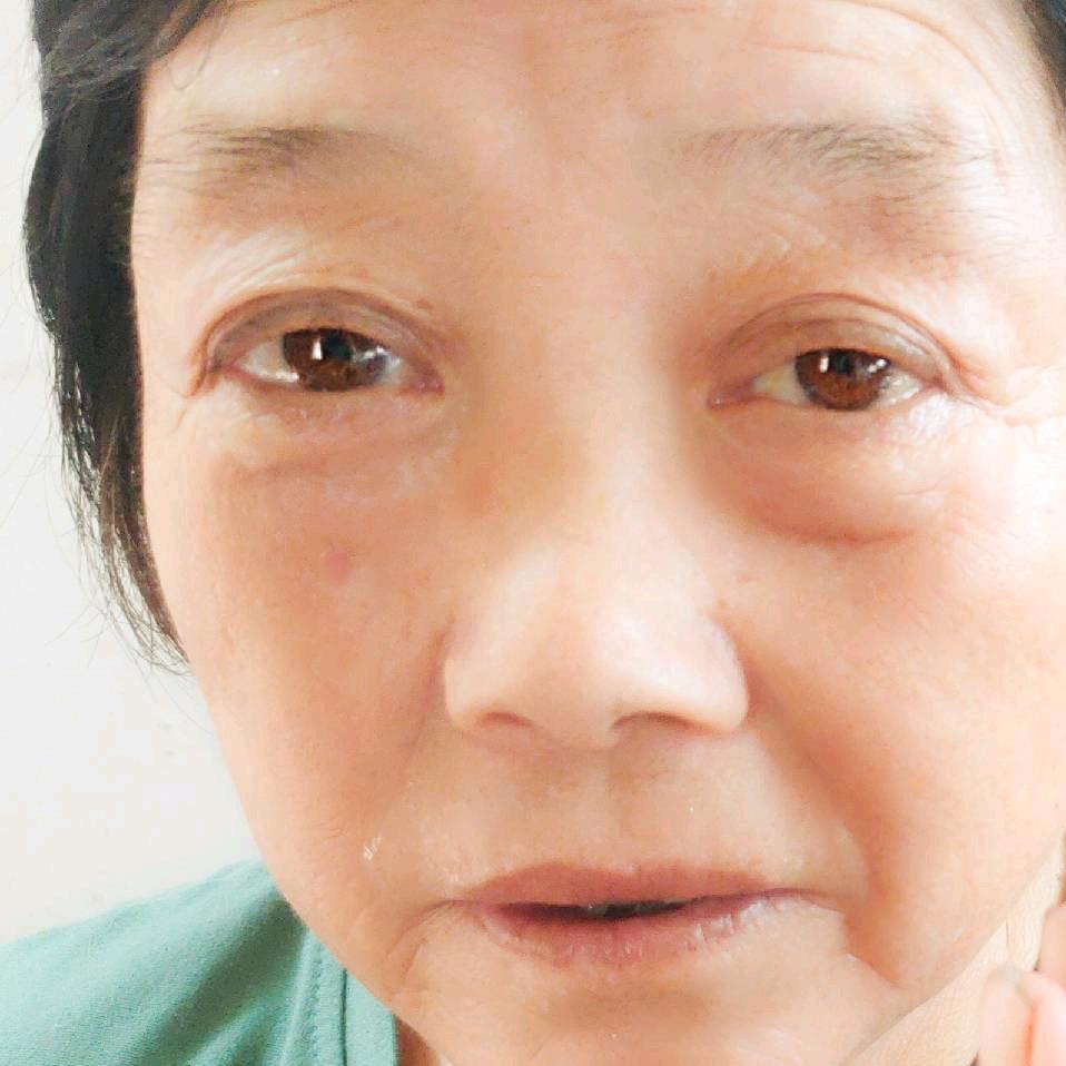 王阿姨