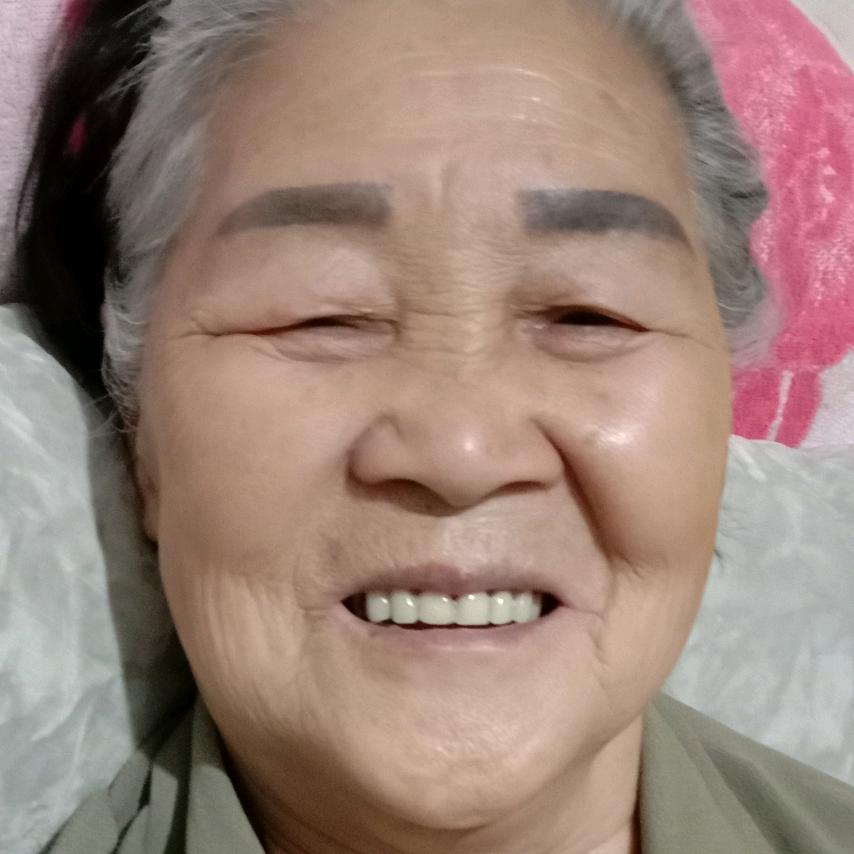 向应芬