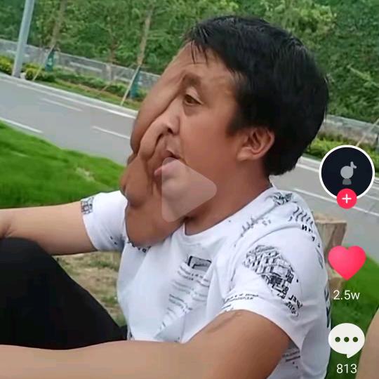 残疾人