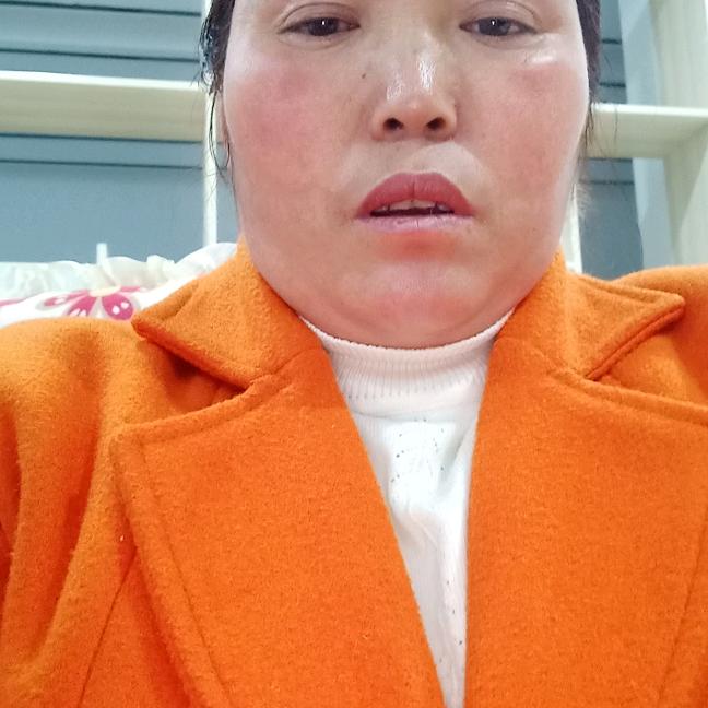 杨朝艳