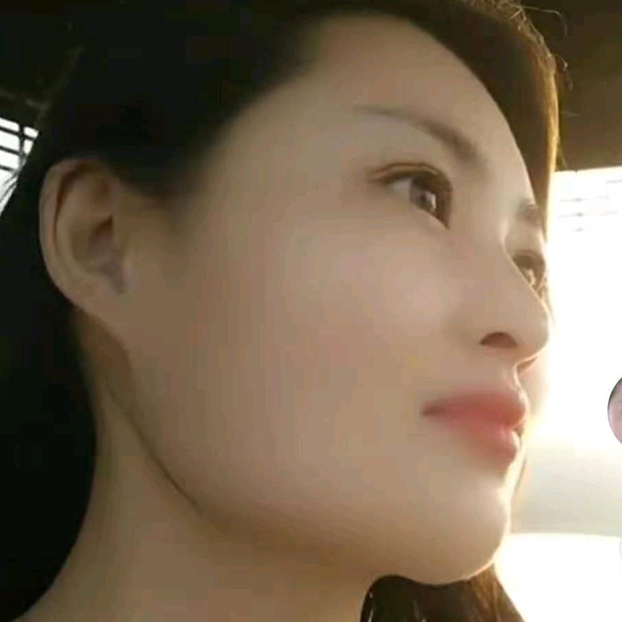 蕾