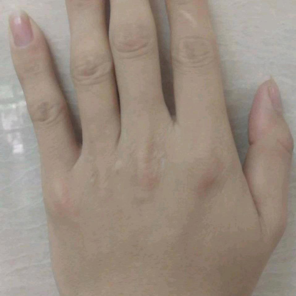 臭宝宝