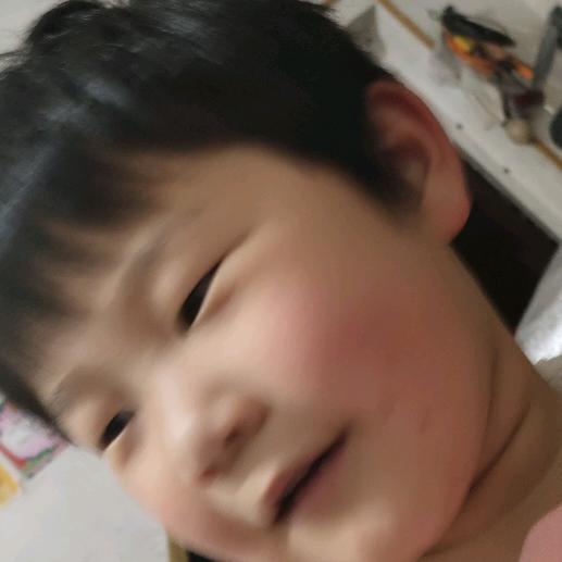神经性皮炎