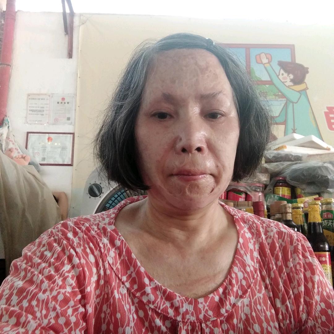 杨术琼