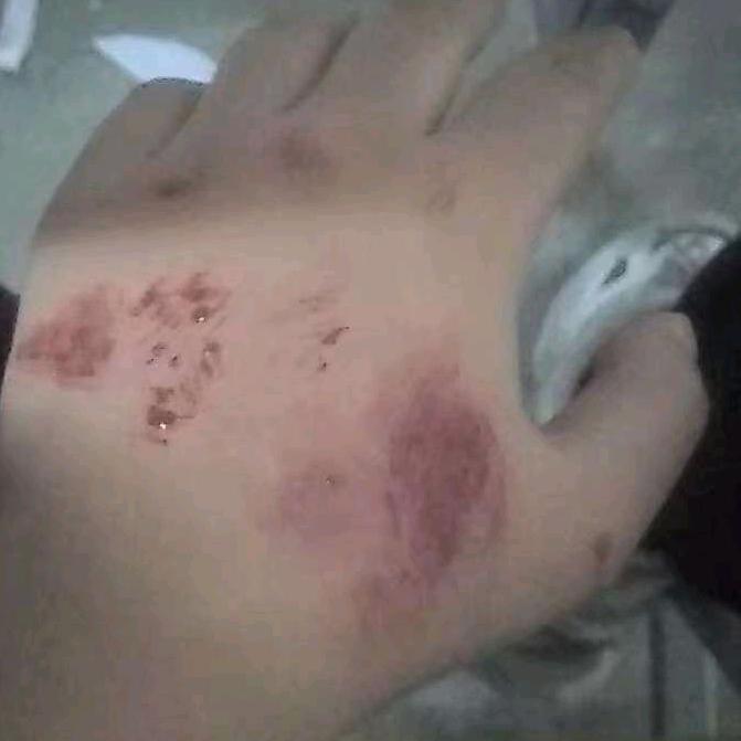 小肥洋