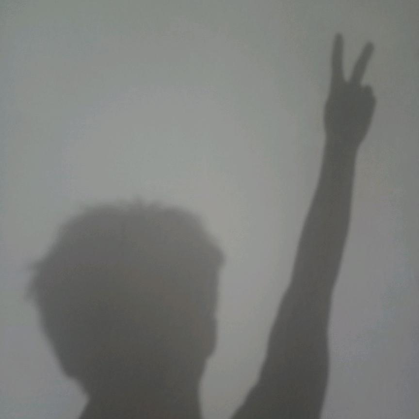 I am very skin