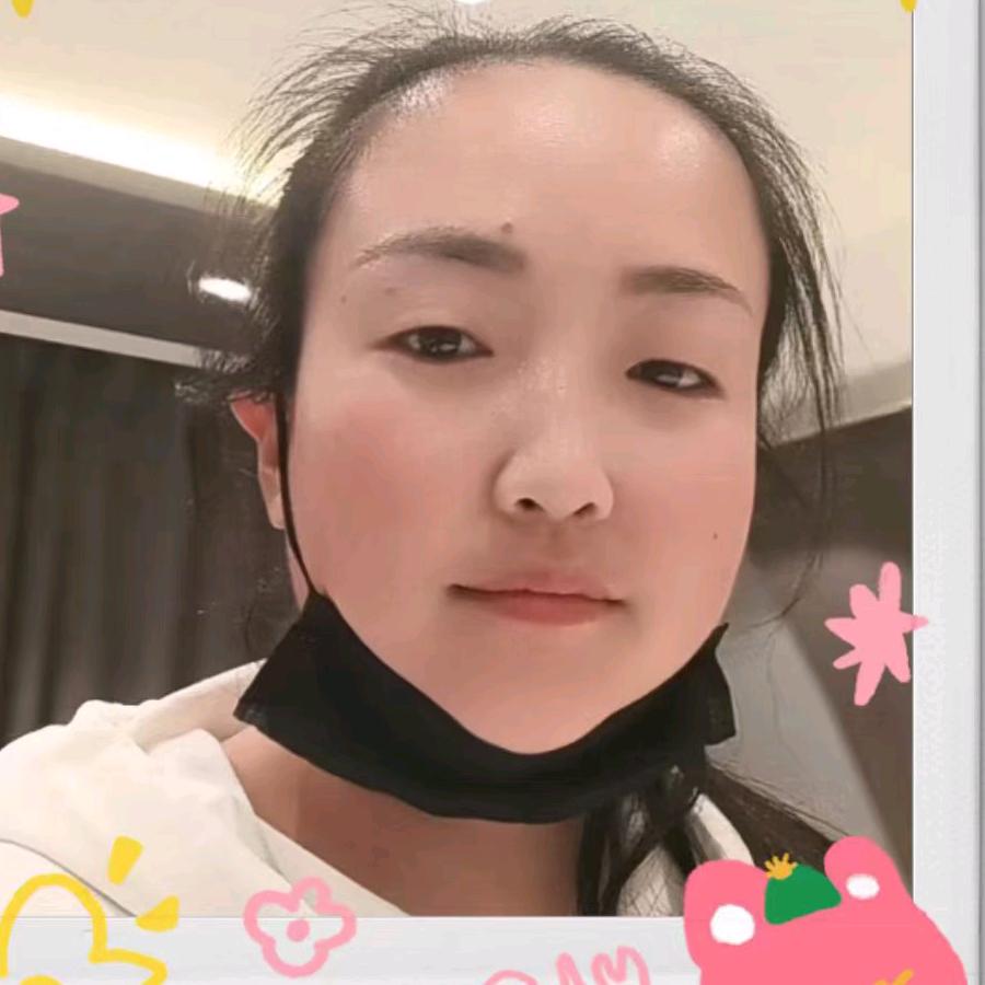 阿芳
