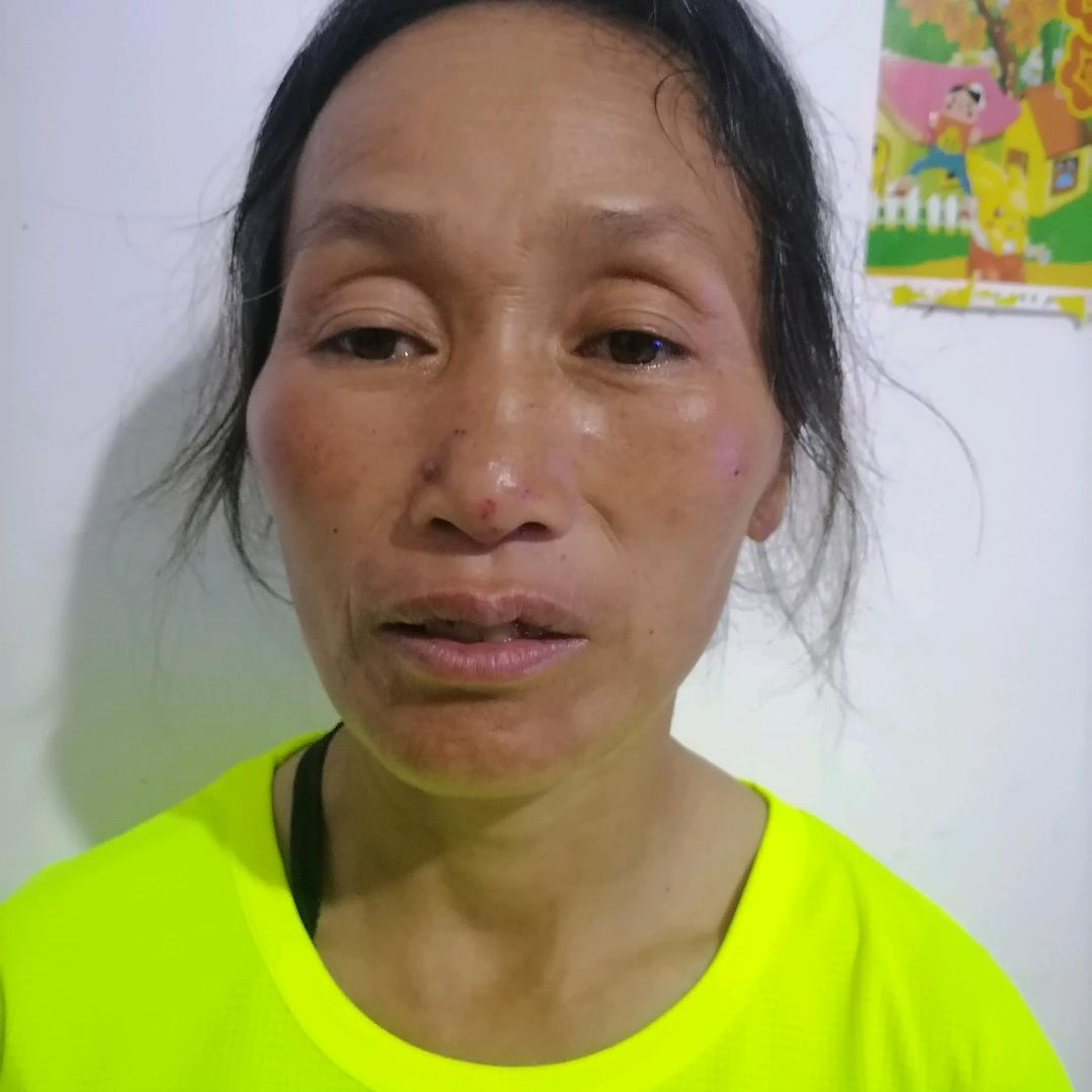 张系英⊙ω⊙