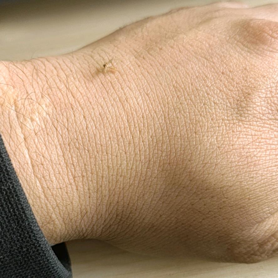 孙大爷（有低保）