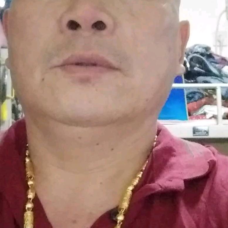 朱小化