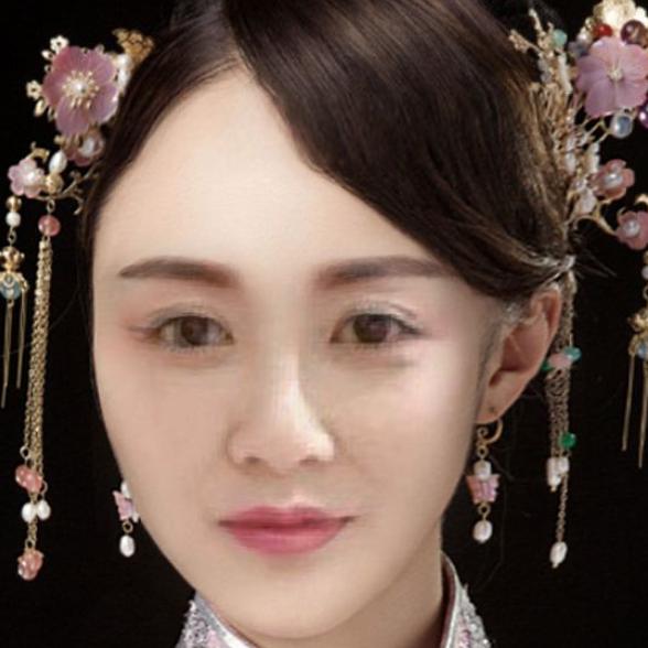 石.