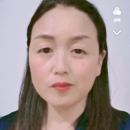 傻妹