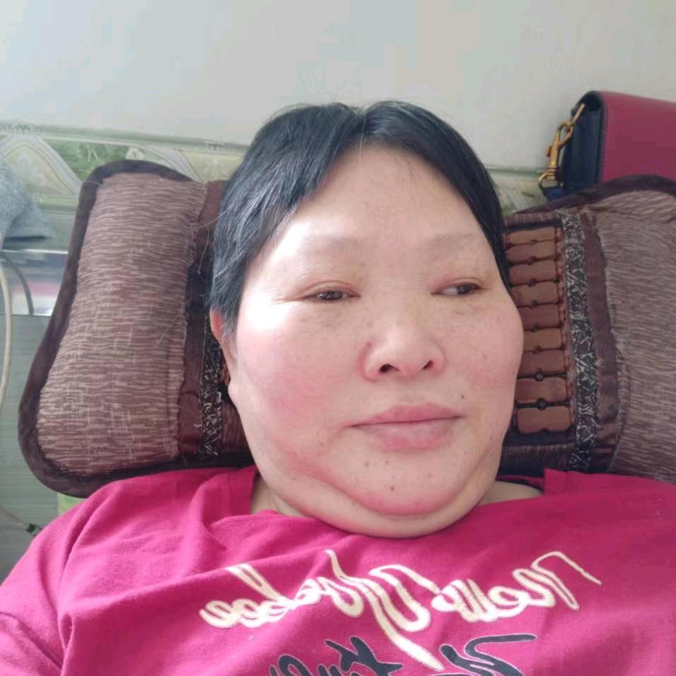 床上二姐（高位截瘫下午4点10开