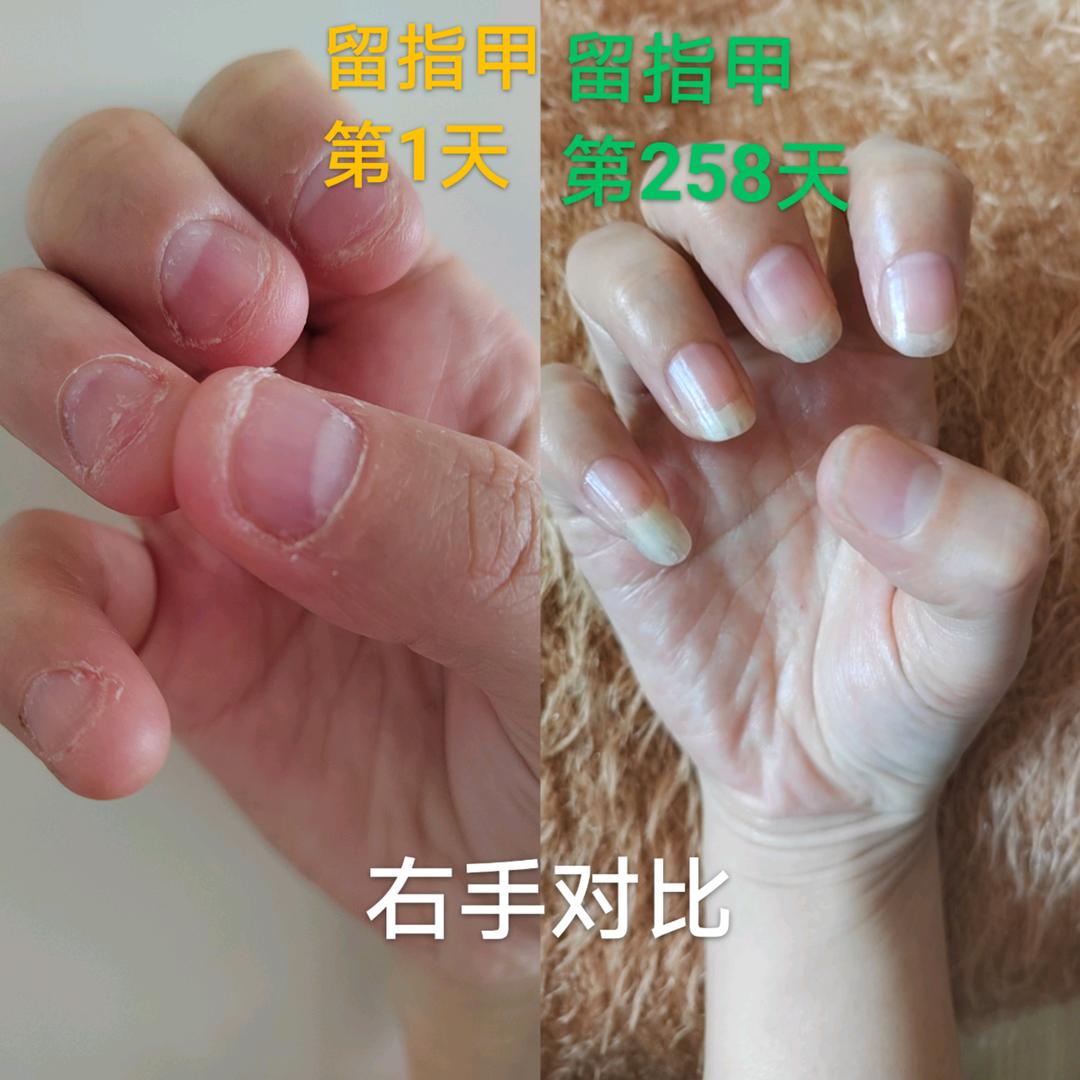 甲族果