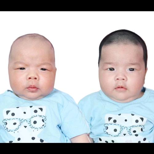 蘑菇豆芽（异卵双胞胎）