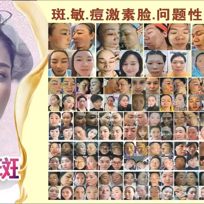7天素颜幼态脸