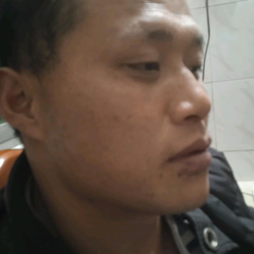 欧辉