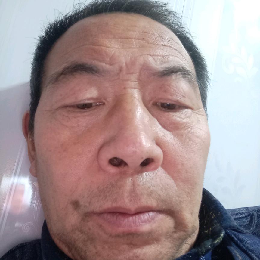 幸运