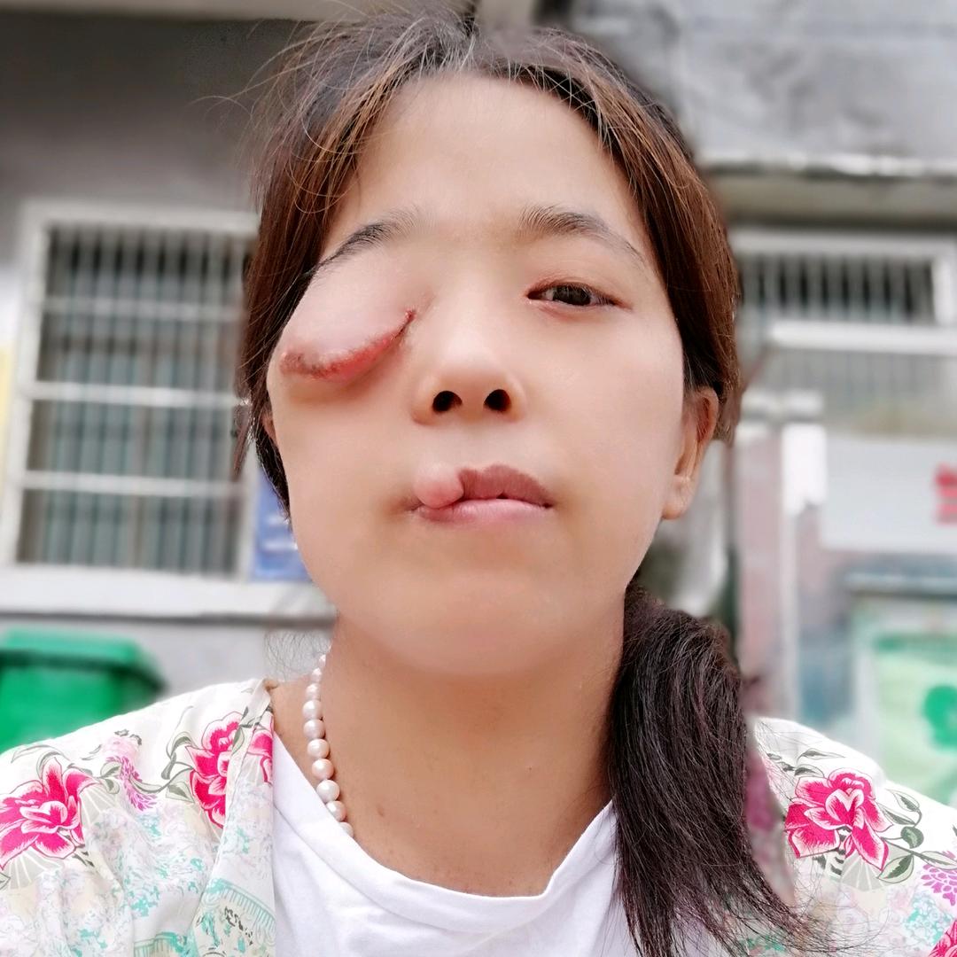 菊菊