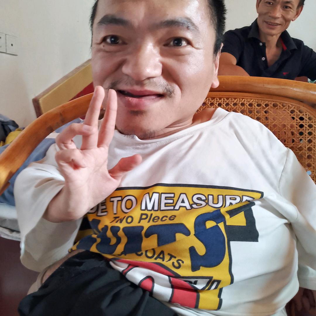 八个点(天生残疾)