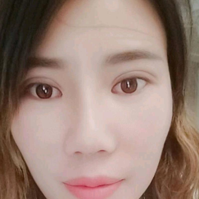 王琴