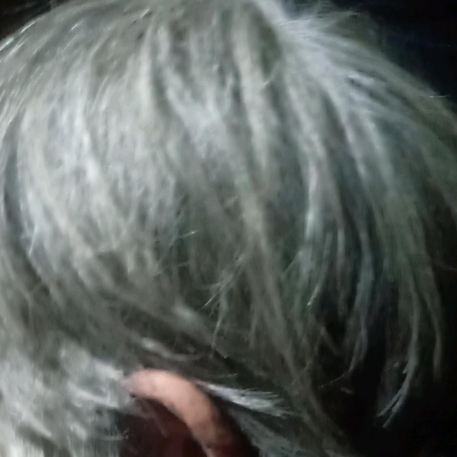 专业治疗白发变黑