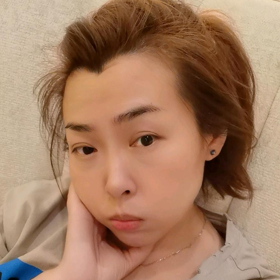 张给丽