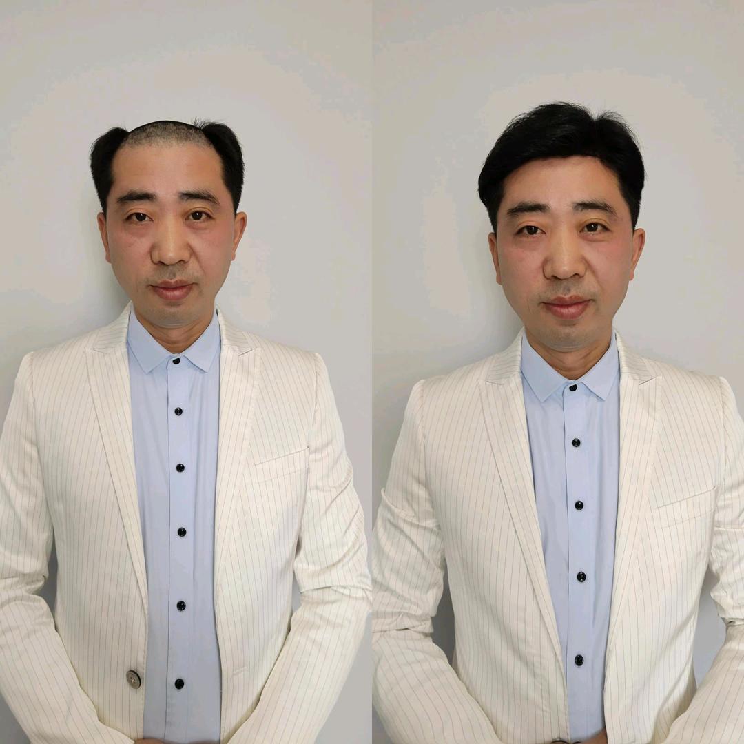 微山老王假发