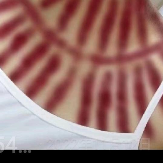 揪痧推拿理疗……拒群聊