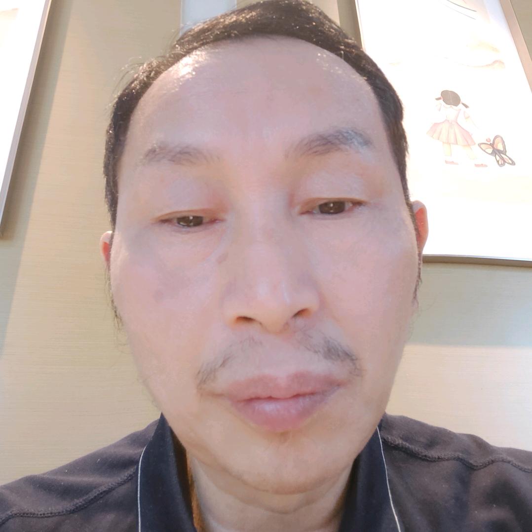 郑哥