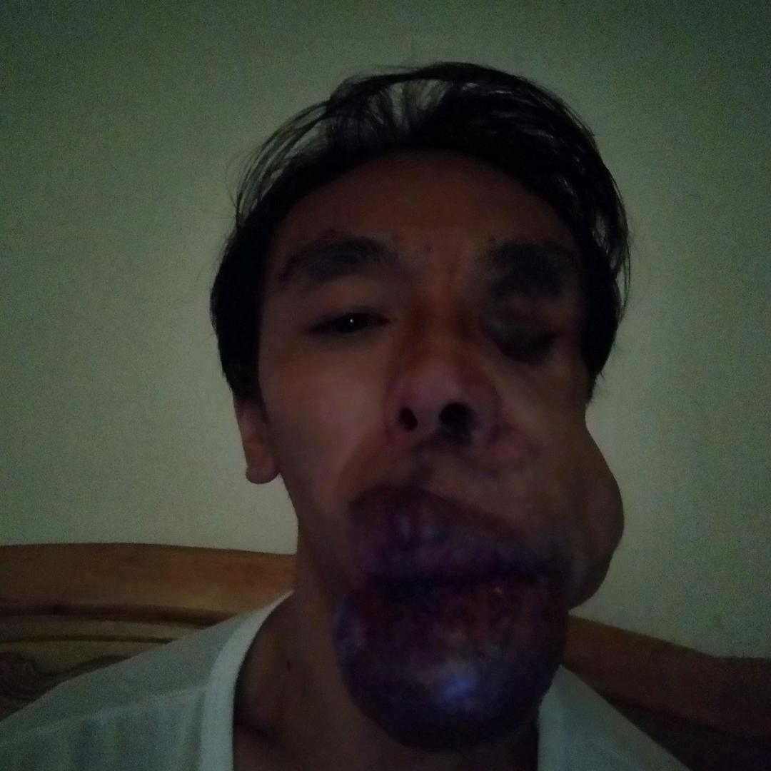 残疾哥