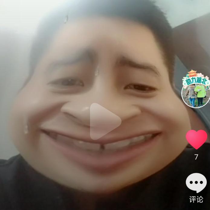 搞笑门牙哥