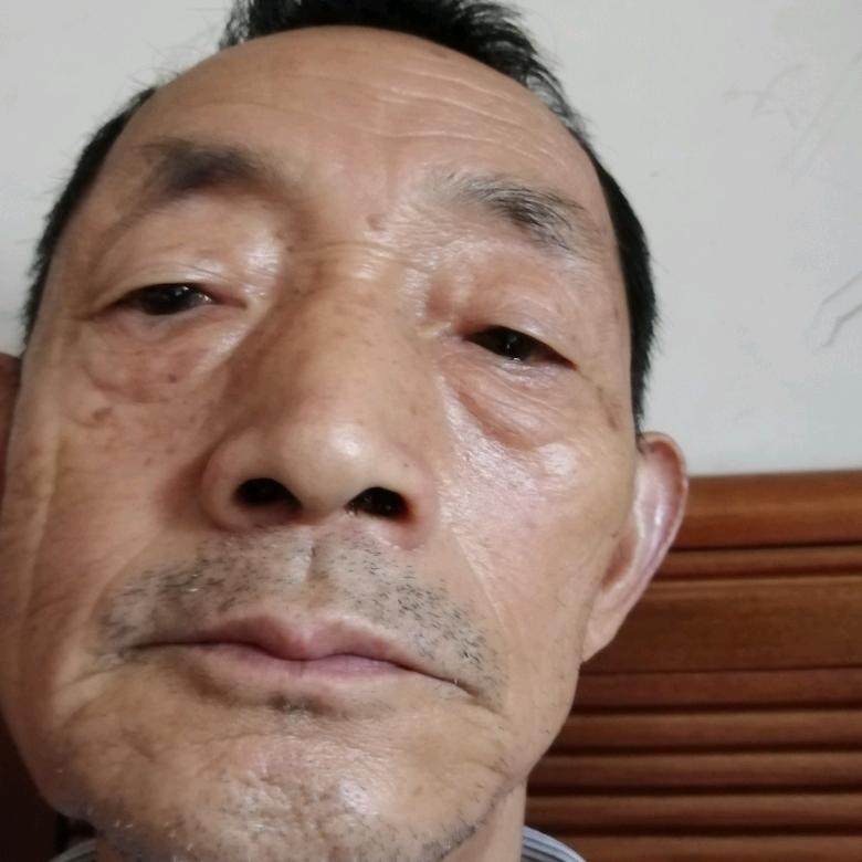 大花地霸主