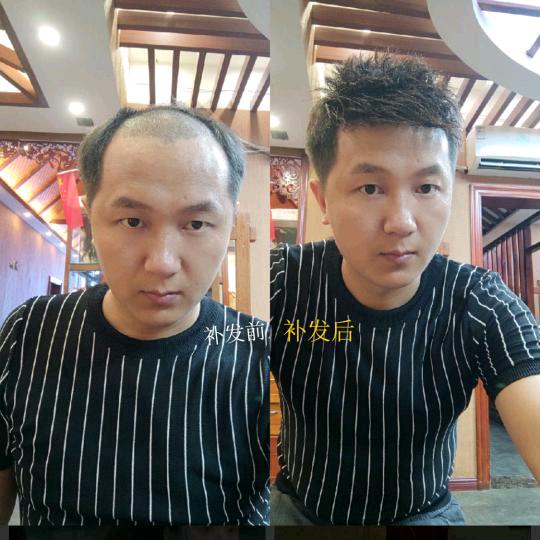 乔治假发世界小龙哥