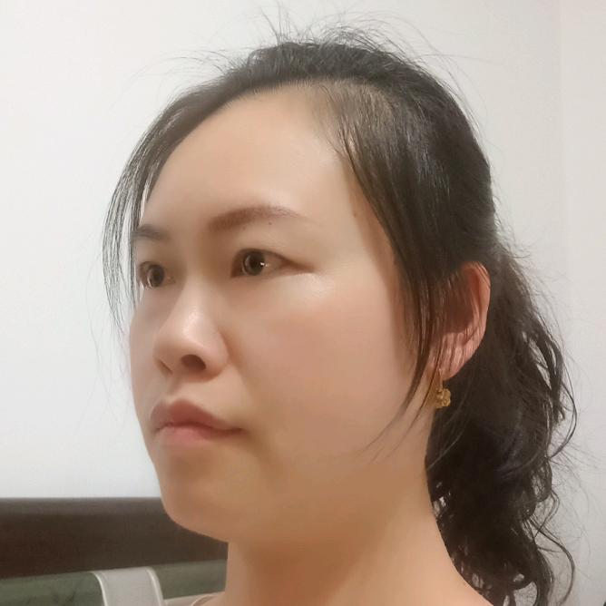 阿美