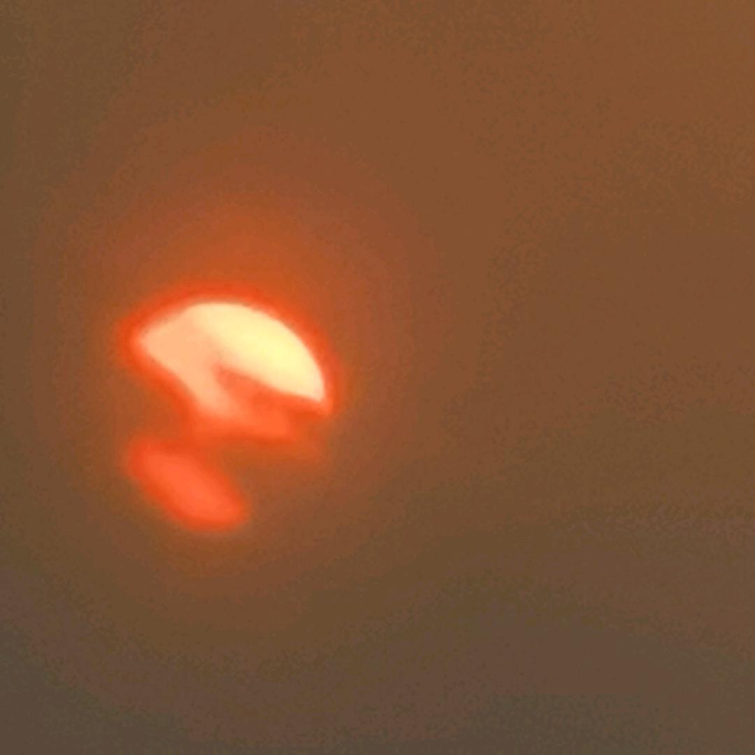 Looking forward to🤒