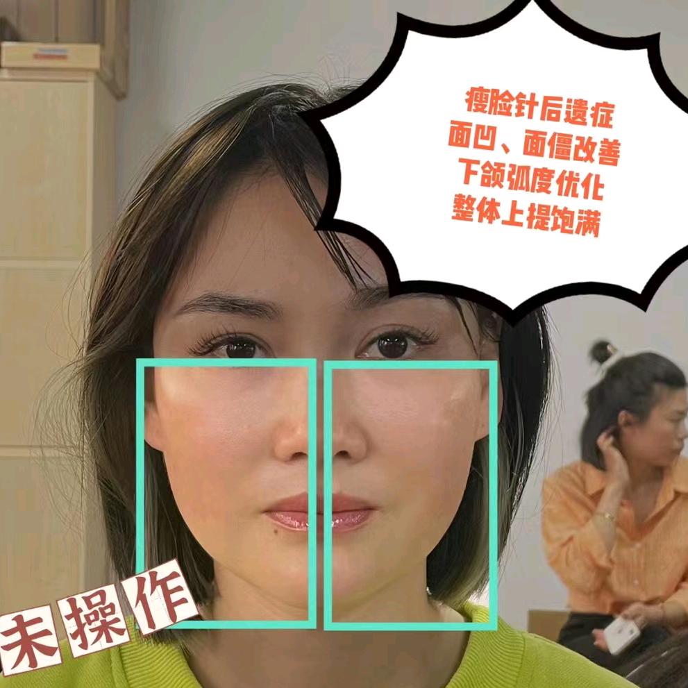 李老师带你健康变美