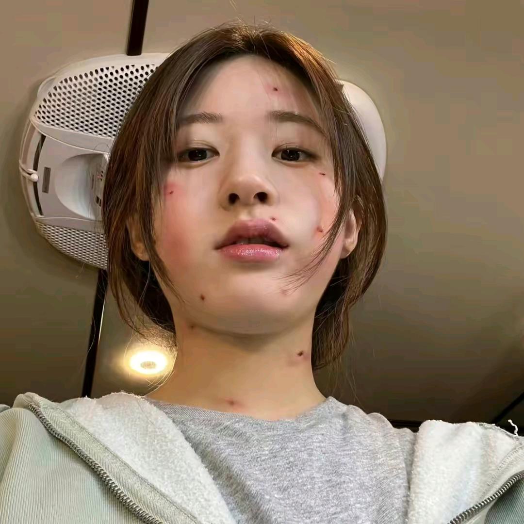 吱吱
